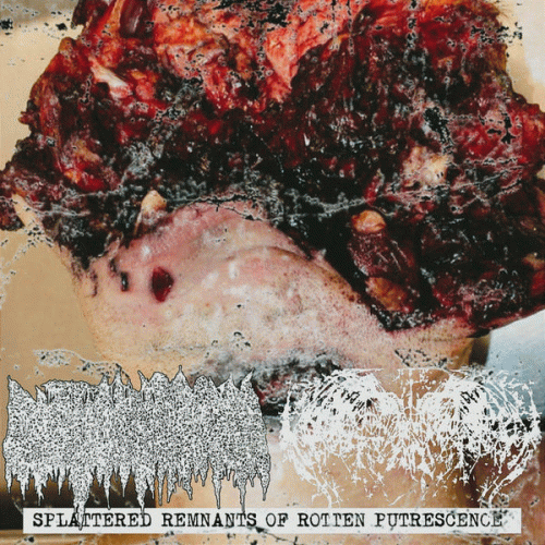 Cystic Hygroma : Splattered Remnants of Rotten Putrescence
